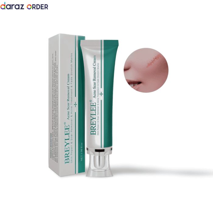 Breylee Acne Scar Cream Clear Skin Repair 30G