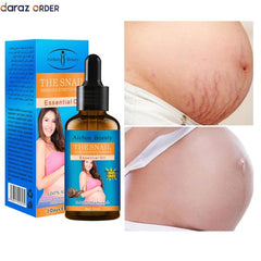 Extract Skin Care Repair Treatment Stretch Marks Oil In Pakistan