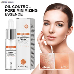 Ouhoe Oil Control Serum 15ml